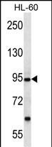 PCDHA12 Antibody (N-term) (Cat. #AP13139a) western blot analysis in HL-60 cell line lysates (35ug/lane).This demonstrates the PCDHA12 antibody detected the PCDHA12 protein (arrow).