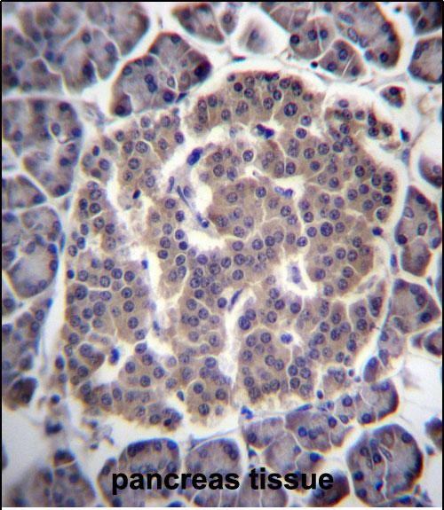 IHC-P - UGCGL1 Antibody (C-term) AP13145B