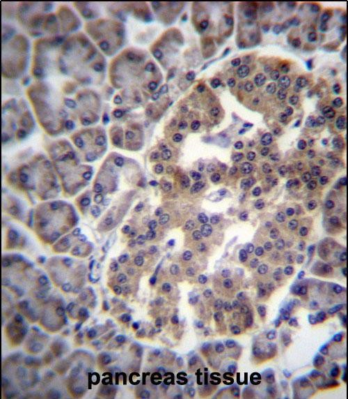 IHC-P - DNAJC14 Antibody (Center) AP13146c