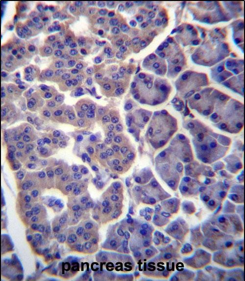 IHC-P - TM9SF2 Antibody (N-term) AP13152A