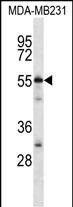 WB - CG025 Antibody (N-term) AP13164A