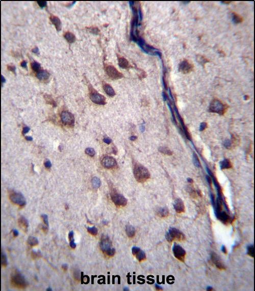 IHC-P - DYSFIP1 Antibody (N-term) AP13166a