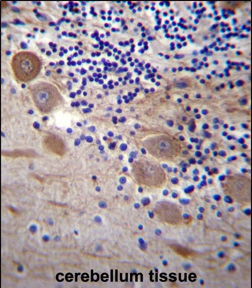 IHC-P - SSR2 Antibody (C-term) AP13170b