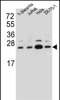 WB - SSR2 Antibody (C-term) AP13170b