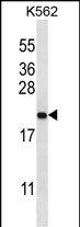 WB - GAGE2B Antibody (N-term) AP13173a