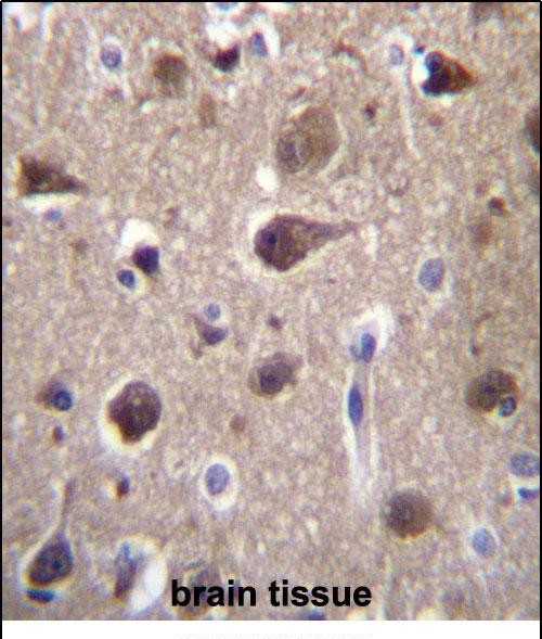 IHC-P - MRAP2 Antibody (Center) AP13187c