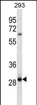 WB - MRAP2 Antibody (Center) AP13187c