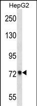 ACSS2 Antibody (Center) (Cat. #AP13231c) western blot analysis in HepG2 cell line lysates (35ug/lane).This demonstrates the ACSS2 antibody detected the ACSS2 protein (arrow).