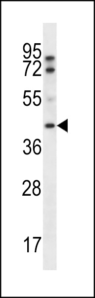 WB - FIBP Antibody (Center) AP13232c