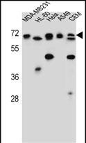 ASMTL Antibody (Center) (Cat. #AP13236c) western blot analysis in MDA-MB231,HL-60,Hela,A549,CEM cell line lysates (35ug/lane).This demonstrates the ASMTL antibody detected the ASMTL protein (arrow).
