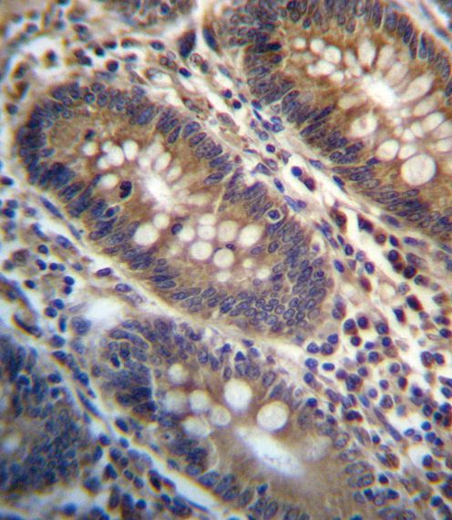 IHC-P - PGAP3 Antibody (Center) AP13237c