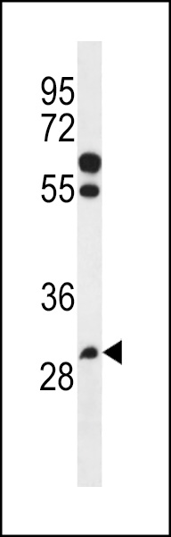 WB - PGAP3 Antibody (Center) AP13237c