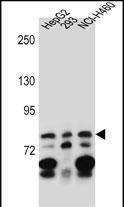 ZNF555 Antibody (C-term) (Cat. #AP13239b) western blot analysis in HepG2,293,NCI-H460 cell line lysates (35ug/lane).This demonstrates the ZNF555 antibody detected the ZNF555 protein (arrow).