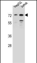 DACH2 Antibody (N-term) (Cat. #AP13241a) western blot analysis in HepG2,Jurkat cell line lysates (35ug/lane).This demonstrates the DACH2 antibody detected the DACH2 protein (arrow).