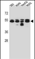 WB - TUBB8 Antibody (N-term) AP13248a