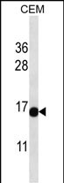 WB - ATAD4 Antibody (C-term) AP13253b