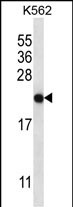 WB - CHAC2 Antibody (Center) AP13260C