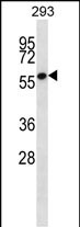 WB - ZNF697 Antibody (N-term) AP13274a