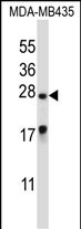 WB - MEA1 Antibody (N-term ) AP13315a