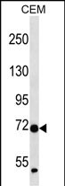 WB - ZNF443 Antibody (N-term ) AP13329A