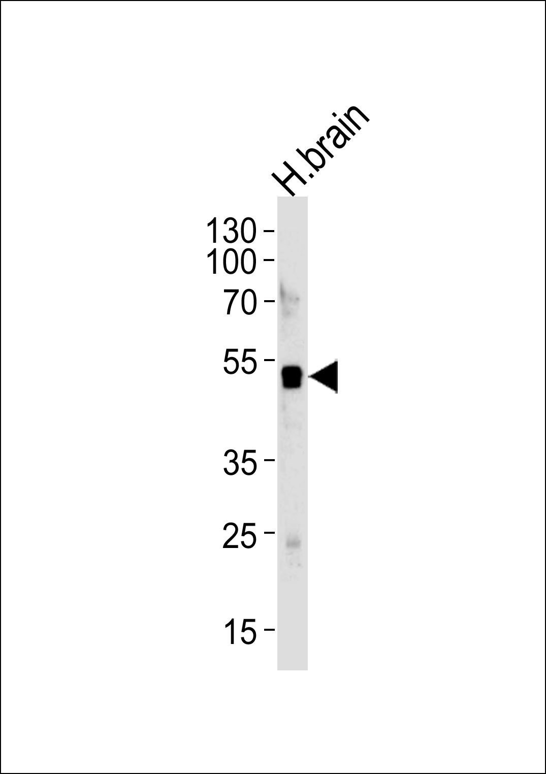 WB - ELAVL3 Antibody (N-term) AP13333a