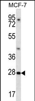 WB - PDCL3 Antibody (N-term) AP13347a