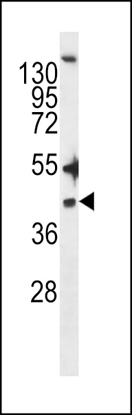 WB - ZDHHC20 Antibody (N-term) AP13355a