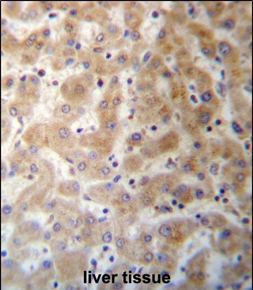 IHC-P - DHFRL1 Antibody (Center) AP13364c