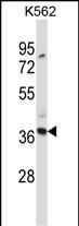 WB - CLEC7A Antibody (N-term) AP13369a