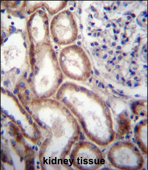 IHC-P - SLIT1 Antibody (N-term) AP13374a