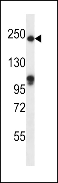WB - SLIT1 Antibody (N-term) AP13374a