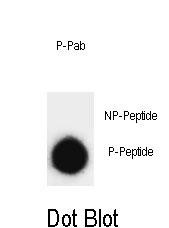 Dot blot analysis of Phospho-SNAP25-pT138 Antibody Phospho-specific Pab (Cat. #AP15001a) on nitrocellulose membrane. 50ng of Phospho-peptide or Non Phospho-peptide per dot were adsorbed. Antibody working concentrations are 0.6ug per ml.
