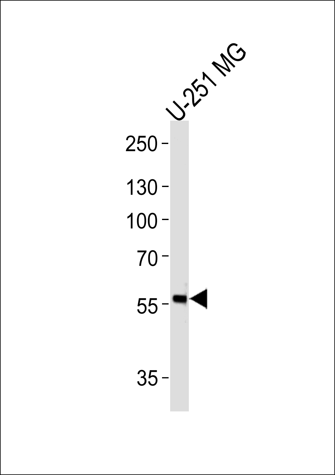 WB - PHF17 Antibody (N-term) AP13432a