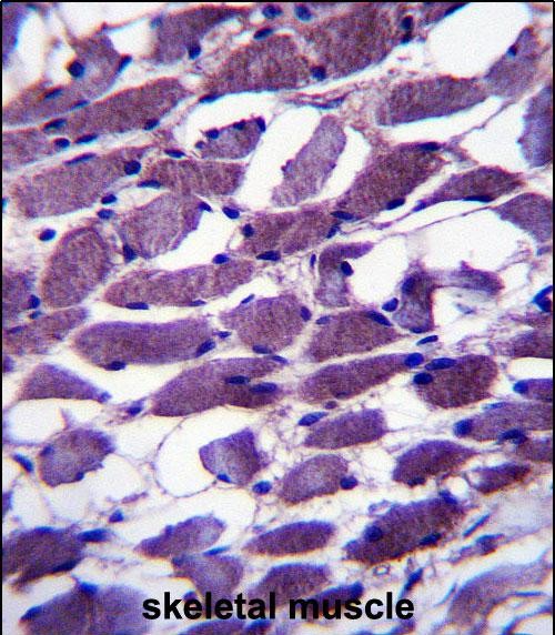 IHC-P - MYOM1 Antibody (Center) AP13444C