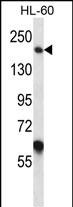 WB - MYOM1 Antibody (Center) AP13444C