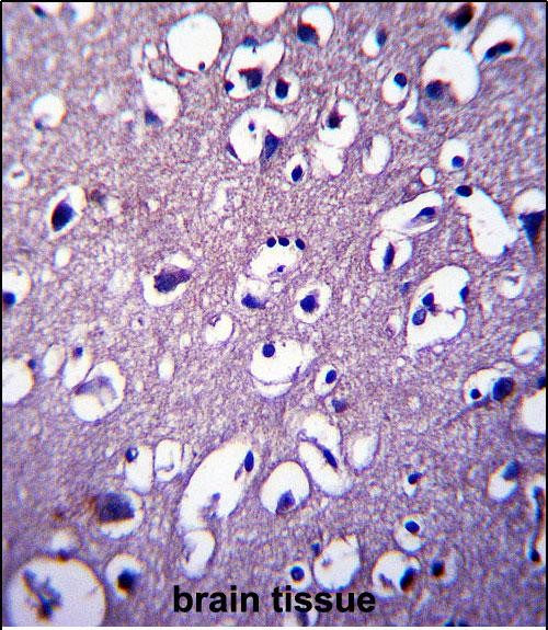 IHC-P - DCTN4 Antibody (N-term) AP13454A