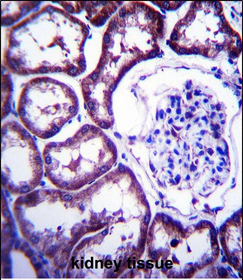 IHC-P - TXNDC15 Antibody (C-term) AP13456B