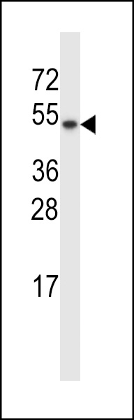 WB - TXNDC15 Antibody (C-term) AP13456B