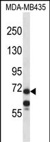 WB - MID1 Antibody (C-term) AP13465b