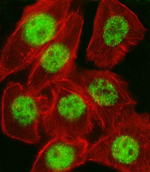 Fluorescent image of A549 cell stained with CDKN1A  Antibody (C-term)(Cat#AP13468b).A549 cells were fixed with 4% PFA (20 min), permeabilized with Triton X-100 (0.1%, 10 min), then incubated with CDKN1A primary antibody (1:25, 1 h at 37?). For secondary antibody, Alexa Fluor� 488 conjugated donkey anti-rabbit antibody (green) was used (1:400, 50 min at 37?).Cytoplasmic actin was counterstained with Alexa Fluor� 555 (red) conjugated Phalloidin (7units/ml, 1 h at 37?).CDKN1A immunoreactivity is localized to Nucleus significantly.