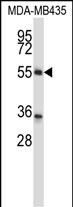 WB - ZNF222 Antibody (N-term ) AP13483a