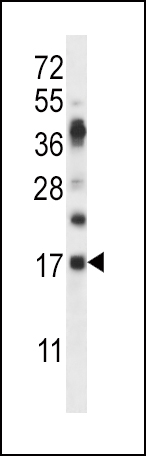 WB - RNASE6 Antibody (C-term) AP13484B