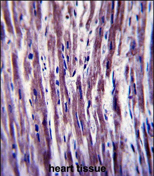 IHC-P - PTPLA Antibody (N-term) AP13486a
