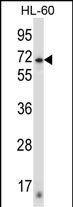 ZNF415 Antibody (N-term) (Cat. #AP13505a) western blot analysis in HL-60 cell line lysates (35ug/lane).This demonstrates the ZNF415 antibody detected the ZNF415 protein (arrow).