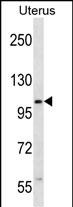 ZSWIM5 Antibody (N-term) (Cat. #AP13517a) western blot analysis in human normal Uterus tissue lysates (35ug/lane).This demonstrates the ZSWIM5 antibody detected the ZSWIM5 protein (arrow).