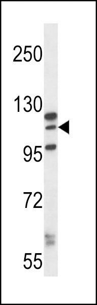 WB - MORC1 Antibody (C-term) AP13528B