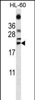 TNF Antibody (C-term) (Cat. #AP13532b) western blot analysis in HL-60 cell line lysates (35ug/lane).This demonstrates the TNF antibody detected the TNF protein (arrow).