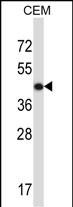 ACTG2 Antibody (C-term) (Cat. #AP13537b) western blot analysis in CEM cell line lysates (35ug/lane).This demonstrates the ACTG2 antibody detected the ACTG2 protein (arrow).