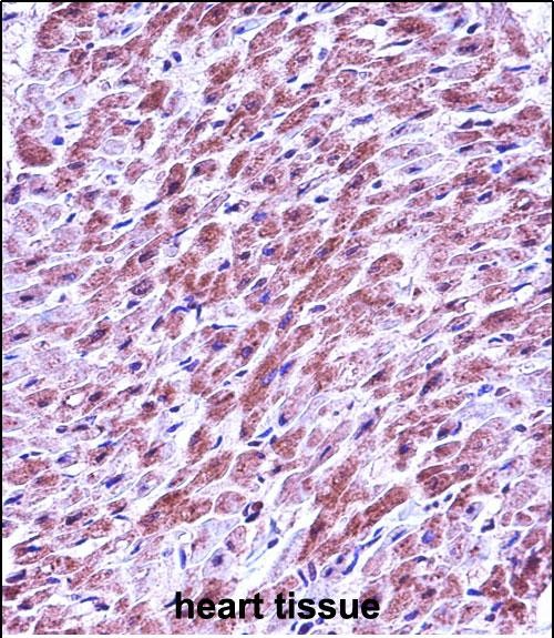 IHC-P - SMAD3 Antibody (Center) AP13540c