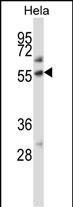 ALPP Antibody (Center) (Cat. #AP13553c) western blot analysis in Hela cell line lysates (35ug/lane).This demonstrates the ALPP antibody detected the ALPP protein (arrow).